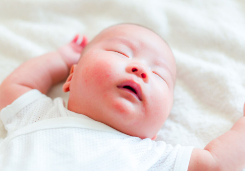 Granitos cara bebé: causas, síntomas y soluciones